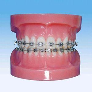 Fixed rectify teeth model (normal)